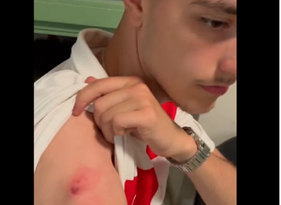 Euro 2024: Un fan croat a fost muşcat de o femeie care voia tricoul lui Ivanusec. Suporterul va primi alt tricou de la fotbalist - VIDEO