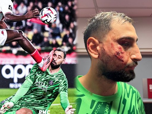 Ligue 1: Wilfried Singo îi cere scuze lui Donnarumma, după ce i-a provocat un traumatism facial la meciul AS Monaco - PSG