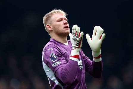 Portarul echipei Southampton a jucat duminică purtând o mănuşă cu patru degete