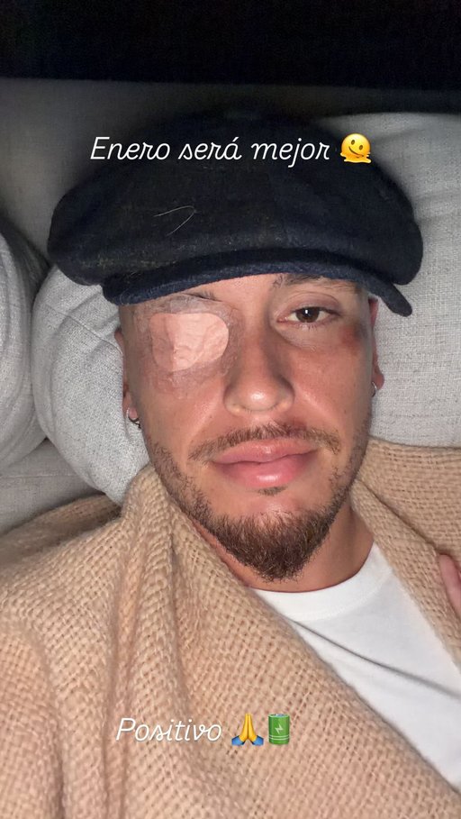 Argentinianul Lucas Ocampos are paralizie facială pe partea stângă