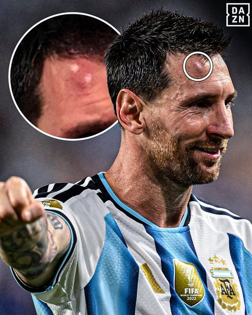 Cupa Mondială 2026: Messi ştia că „urma să fie un meci foarte greu” împotriva Capului Verde / Starul argentinian, aşteptat de jucătorii adverşi pentru poze - VIDEO