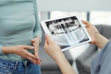 COMUNICAT DE PRESĂ: Mai poti manca dulciuri daca ai implant Megagen? Raspunsul care iti va schimba dieta 