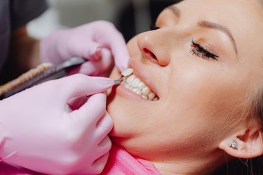 Aparat dentar sau faţete? Ce să alegi