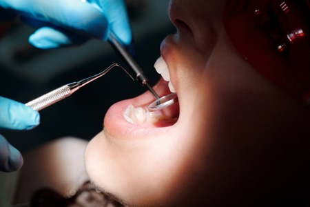 De ce se inflamează gingiile? 3 semne