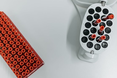 Top 5 analize medicale pe care ar trebui să le faci anual