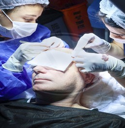 Transplant de păr în Turcia cu tehnica Vita (P)