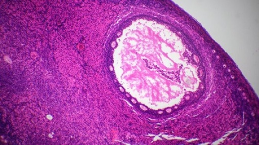 Cercetătorii danezi au dezvoltat un tratament de fertilitate cu ajutorul ovarelor artificiale