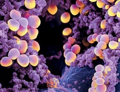Studiu: ”Superbacteriile” devin tot mai rezistente la dezinfectanţii pe bază de alcool