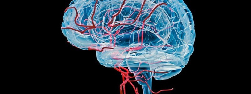 Studiu: Atacul vascular cerebral dublează riscul de demenţă