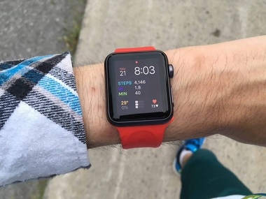 Chirurgii vor folosi Apple Watch pentru a monitoriza pacienţi operaţi la şold sau genunchi