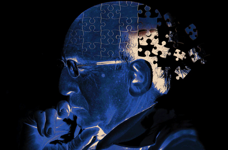 Un test care foloseşte inteligenţă artificială ar putea depista mai devreme maladia Alzheimer