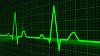 Oamenii pot fi identificaţi după ritmul cardiac