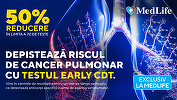 Află dacă ai risc de cancer pulmonar. MedLife oferă reducere de 50% la Testul Early CDT