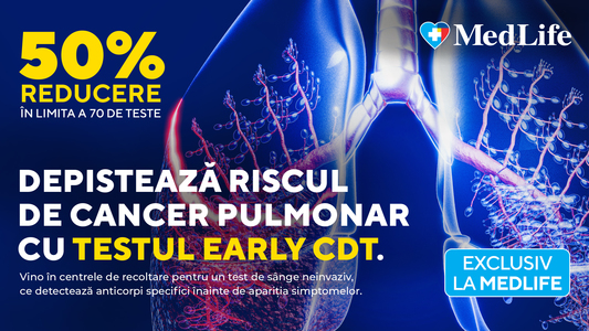 Află dacă ai risc de cancer pulmonar. MedLife oferă reducere de 50% la Testul Early CDT