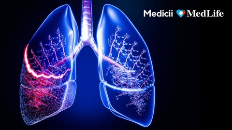 Medic pneumolog: „Nu ignora o tuse care durează mai mult de două luni”. Când simptomele respiratorii ascund afecţiuni serioase