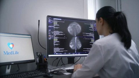 Accidentele vasculare cerebrale pot fi prevenite. Neurolog: “60-70% dintre cazuri au la bază cauze controlabile legate de mediul şi stilul de viaţă”