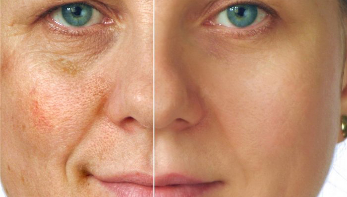 Masca de fata care albeste tenul. Cum se prepara