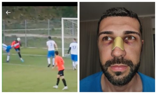 VIDEO | ”Puteam să mor!”. Un fotbalist cu zeci de meciuri în Superligă se retrage din cauza unui fault ”criminal” suferit