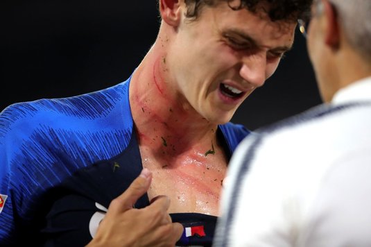 VIDEO | "E doar o zgârietură!" Accidentare urâtă suferită de Benjamin Pavard în meciul cu Germania