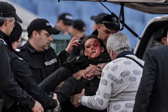Imagine şocantă după ŢSKA Sofia - Levski Sofia. O poliţistă a fost operată de urgenţă: "Nu a fost o petardă, ci o bombă"