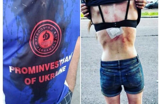 FOTO | Au bătut crunt o fată de 18 ani! Scene şocante la finala Cupei Ucrainei. ”Mă uitam în jurul meu şi vedeam numai sânge”