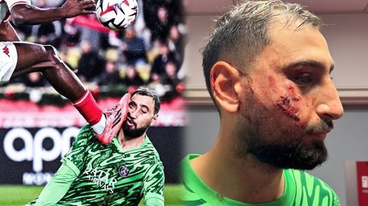 Explicaţia lui Wilfried Singo după ce i-a provocat un traumatism facial lui Donnarumma