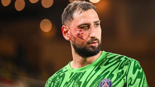 Primul verdict al medicilor în cazul accidentării lui Donnarumma. Ce perioadă minimă va sta pe bară portarul lui PSG, după intrarea lui Singo