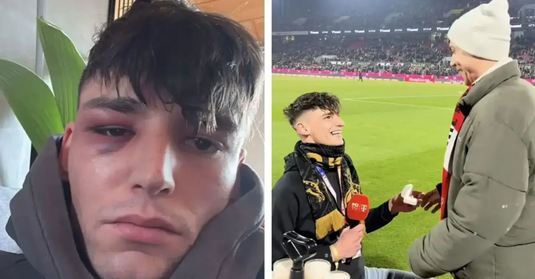 Arbitrul Pascal Kaiser, care şi-a cerut iubitul în căsătorie pe stadionul din Köln, a fost victima unei alte agresiuni în faţa casei sale