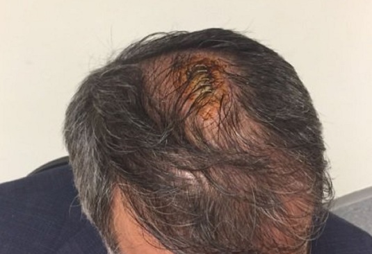 VIDEO&FOTO | Scene şocante la Fener - Beşiktaş. Antrenorul  Senol Gunes a fost grav rănit la cap. Meciul a fost suspendat după o bătaie generală la vestiare