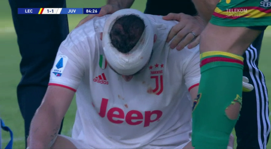VIDEO | Clipe de groază la meciul lui Juventus! Higuain a fost făcut KO. Campioana, doar egal la Lecce