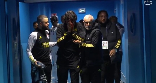 Autocarul lui Lyon a fost atacat cu pietre înainte de meciul cu Marseille! Fabio Grosso a fost rănit la faţă şi a coborât plin de sânge | UPDATE Meciul, suspendat | VIDEO