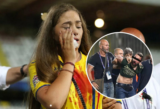 FOTO | Imagini şocante din timpul meciului România - Franţa. Cum arăta iubita lui Manea după ce a fost lovită în plină figură şi bărbatul scos în afara terenului după incidente