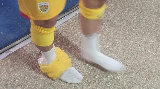 Alertă la FCSB! "Tricolorul" s-a accidentat după doar câteva minute în Cipru - România | FOTO
