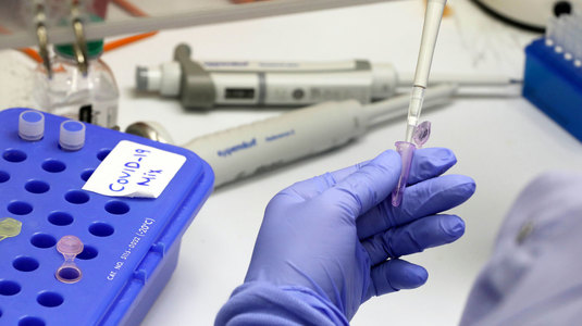 Testele rapide pentru detectarea noului coronavirus vor putea fi folosite de sportivi