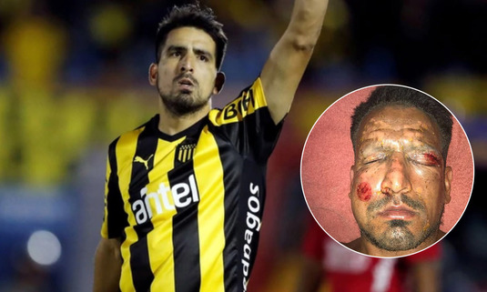 FOTO | Incident şocant de sărbători pentru un internaţional argentinian! Cum arată după ce o petardă i-a explodat în faţă