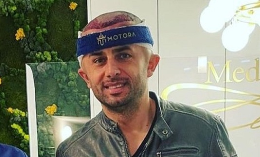 FOTO | Cum arată Nicolae Dică după ce şi-a făcut implant de păr. Apariţie spectaculoasă a fostului secund al naţionalei