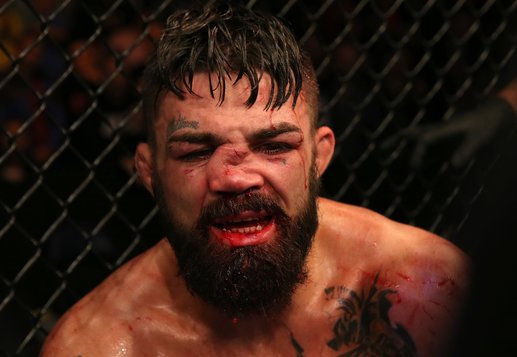 Atentie, imagini cu impact emoţional! VIDEO | Un luptător şi-a pierdut nasul la ultima gală UFC 