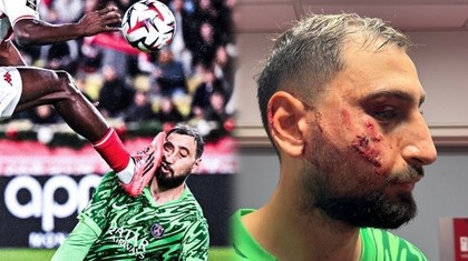 Fundaşul Wilfried Singo a primit mesaje cu caracter rasist după ce l-a accidentat pe Donnarumma. ”Un astfel de comportament nu îşi are locul în sport”