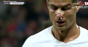 VIDEO ǀ Ronaldo a fost făcut KO de portarul Cehiei. Starul Portugaliei, serios şifonat, dar a putut continua
