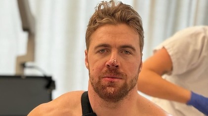 Aleksander Aamodt Kilde va fi operat la umăr şi la gambă, după căzătura de la Wengen