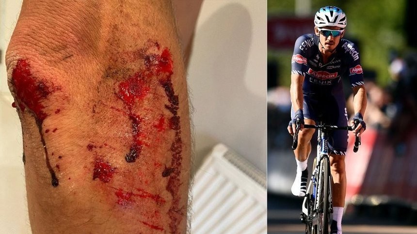 Ciclistul britanic Alexandar Richardson, agresat şi jefuit cu violenţă de bărbaţi mascaţi în timpul unui antrenament