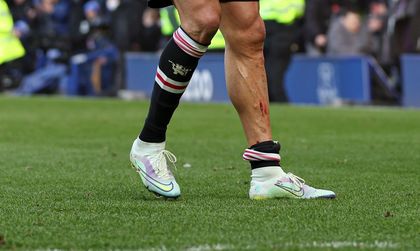 VIDEO | Ronaldo a cedat nervos. Gestul urât făcut de CR7 după ce adversarii i-au umplut piciorul de sânge