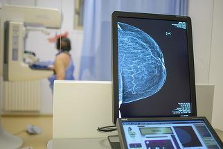 Mamografii gratuite, doar cu bilet de trimitere de la medicul de familie