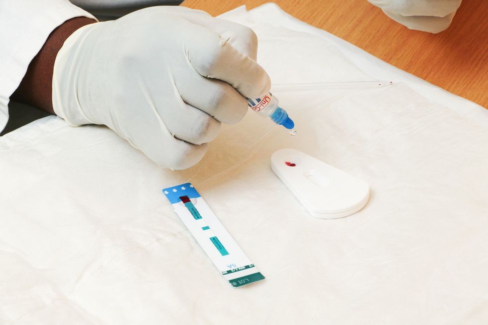 Testări pentru HIV/SIDA şi hepatita B şi C, decontate pentru gravidele neasigurate de la 1 iulie