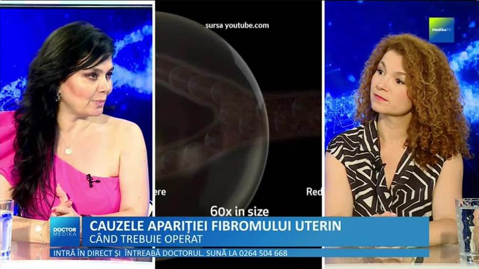 VIDEO. Kilogramele în plus sau slăbitul brusc, factori de risc pentru fibromul uterin