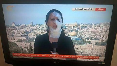 Israel grenade tv reporter bandaged Hana Hammad_ The independent