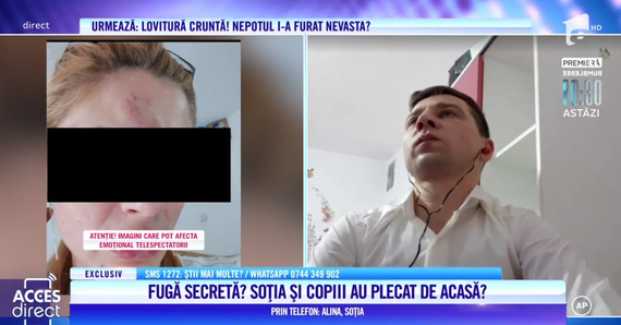 Un nou caz legat de Acces Direct! Femeie bătută de soţul violent, pe care-l părăsise. În emisiune a fost încurajată să-l lase să-şi vadă copiii