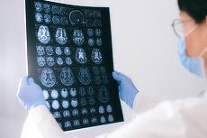 COMUNICAT. Ce presupune o intervenţie minim invazivă în neurochirurgie?