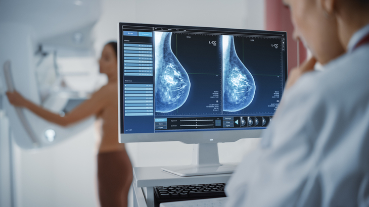 COMUNICAT. Avantajele unei mamografii realizate cu aparatură de ultimă generaţie
