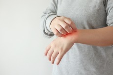 COMUNICAT. Coalitia COPAC în Lupta pentru Drepturile Pacienţilor cu Dermatită Atopică: Spune DA şi Beneficiază de Tratament Gratuit!